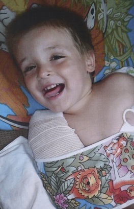 A photograph of Eric Dean with his arm broken was an exhibit presented as evidence by the prosecution during the May 2014 trial of Amanda Peltier.