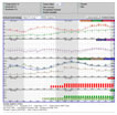 Hourly Weather Forecast Graphs or Meteograms - Click to Open