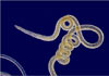 Nematode worm (Brugia pahangi) [Copyright: Micrographia, used with permission]