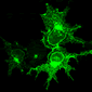 Immunofluorescent image of KIAA0319 protein in cells.