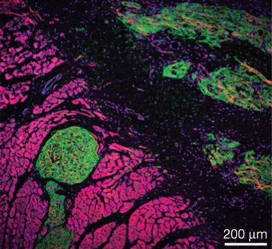 Photo: Implanted Heart Cells Stifle Irregular Rhythms: http://www.nih.gov/researchmatters/august2012/08272012heart.htm

Image information: Scientists showed that transplanted human heart cells (green) could beat in sync with neighboring guinea pig cells (pink) and prevent abnormal rhythms. Image by Shiba et al., courtesy of Nature.