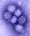 Foto: imagen del virus de la influenza H1N1