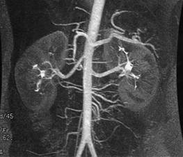 Kidney anatomy and physiology