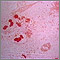 Haemophilus influenza organism