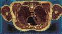 Visible Human Cross Section