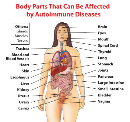 Body parts that can be affected by autoimmune diseases