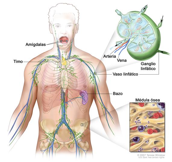 Sistema linfático; el dibujo muestra los vasos linfáticos y los órganos linfáticos, incluso los ganglios linfáticos, las amígdalas, el timo, el bazo y la médula ósea. Un recuadro muestra la estructura interior de un ganglio linfático y de los vasos linfáticos adjuntos, con flechas que indican como circula la linfa (un líquido claro) hacia adentro y afuera del ganglio linfático. Otro recuadro muestra una vista ampliada de la médula ósea con células sanguíneas.