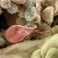 microscopic image of Giardia lamblia