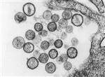 In this undated handout from the Centers for Disease Control image library, this transmission electron micrograph (TEM) reveals the ultrastructural appearance of a number of virus particles, or “virions”, of a hantavirus known as the Sin Nombre virus (SNV). REUTERS/Cynthia Goldsmith/CDC/Handout