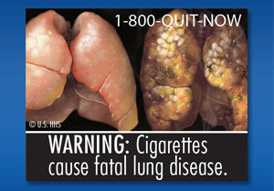 WARNING: Cigarettes cause fatal lung disease. Image: Healthy lungs next to diseased lungs. Smoke around diseased lungs.
Cessation Resource: 1-800-QUIT-NOW
Copyright: U.S. HHS