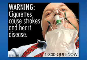 WARNING: Cigarettes cause strokes and heart disease. Image: Man barely conscious with oxygen mask on face.
Cessation Resource: 1-800-QUIT-NOW
Copyright: U.S. HHS