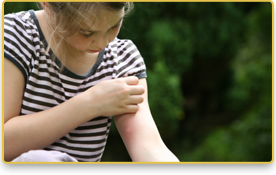 Una niña muestra una picadura de mosquito