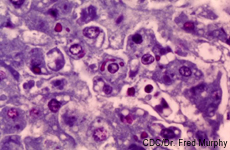 Micrograph of human hepatocytes infected with the Ebola virus