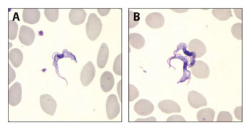 image of trypanosome brucei