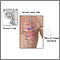 Incisión para biopsia de tejido pleural