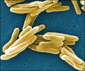 Tuberculosis under a microscope