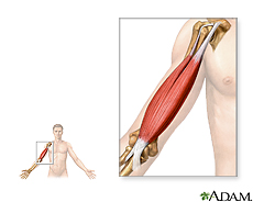 Illustration of arm muscle