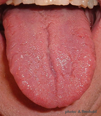 A photograph of a tongue