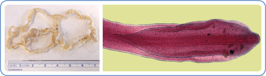 L: Section of an adult D. latum containing many proglottids. The scolex was not present in this specimen. Scale is in centimeters and the section of the this worm is ~7 centimeters long and appears to be bigger because it is folded in on itself. R: Scolex of D. latum.