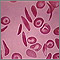 Glóbulos rojos drepanocíticos múltiples