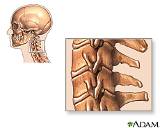 Ilustración de los vértebras cervicales