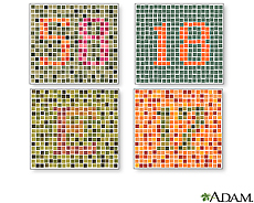 Ilustración de diversas pruebas para el daltonismo 
