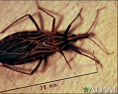 Fotografía de un insecto triatomino o chinche besucón