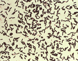 Clostridium perfringens bacteria that had been grown in Schaedler’s broth