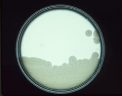 Cultures of Clostridium perfringens grown on an egg yolk agar plate