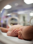 Photo of a baby during continuous positive airway pressure (CPAP) treatment.