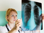 image of female medical professional holding up a lung x-ray 