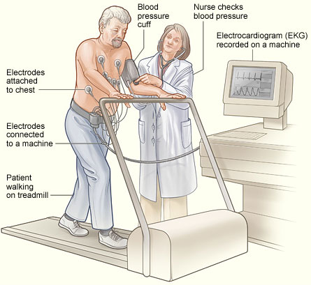 The illustration shows a patient having a stress test. Electrodes are attached to the patient's chest and connected to an EKG (electrocardiogram) machine. The EKG records the heart's electrical activity. A blood pressure cuff is used to record the patient's blood pressure while he walks on a treadmill.