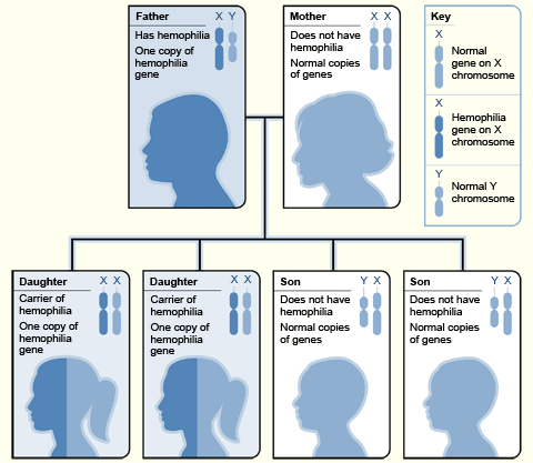 The image shows one example of how the hemophilia gene is inherited. In this example, the father has hemophilia (that is, his X chromosome is faulty). The mother isn't a hemophilia carrier (that is, she has two normal X chromosomes).  Each daughter will inherit the faulty gene from her father and be a carrier. None of the sons will inherit the faulty gene from their father; thus, none will have hemophilia.   