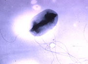 Scientific close-up photo of the E. Coli 0157-H7 bacterium