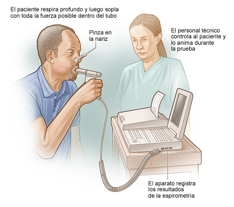 La ilustración muestra cómo se hace una espirometría. El paciente respira profundo y luego sopla con fuerza por un tubo conectado al espirómetro. El espirómetro mide la cantidad de aire exhalado. También mide la velocidad con que se exhaló.