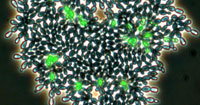 Image showing green cells undergoing cell death.