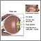 Anatomía de un ojo envejecido