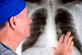 Doctor examining lung x-ray