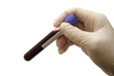 Blood sample in test tube