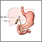 Gallbladder anatomy