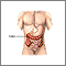 Colon diverticula - series