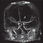 Dynamic CT-angiography with contrast extravasation representing ongoing bleeding - Copyright: Elsevier