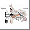 Otoscopic exam of the ear