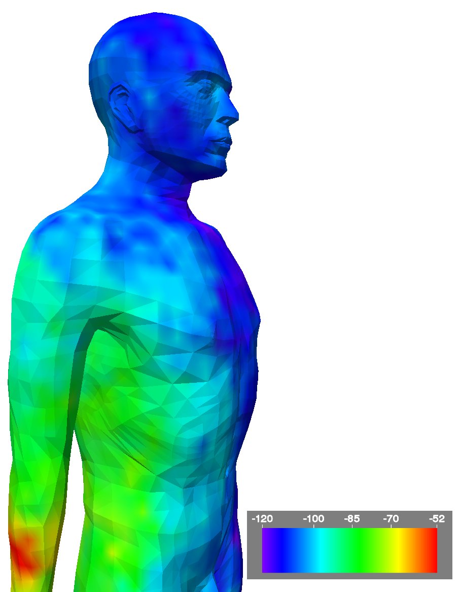 Simulation of a transmitter implanted in the right forearm. Color denotes signal strength.