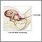 Internal fetal monitoring