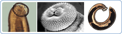 Left/Right: Third-stage larva of Gnathostoma spinigerum, head and whole larva respecitvely. Center: Scanning electron micrograph of a Gnathostoma spinigerum female worm's head bulb.