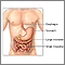 Enfermedad inflamatoria intestinal - Serie