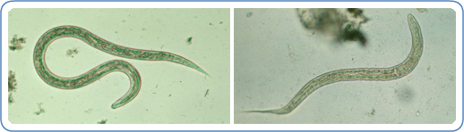 Left: Filariform (L3) hookworm larva in a wet mount. Right: Hookworm rhabditiform larva (wet preparation).