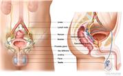 Anatomy of the  male reproductive and urinary systems; drawing shows front and side views of ureters, lymph nodes, rectum, bladder, prostate gland, vas deferens, urethra, penis, testicles, seminal vesicle, and ejaculatory duct.