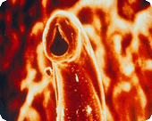 Highly magnified image of a Hookworm.